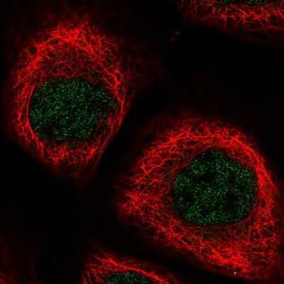 Immunocytochemistry/Immunofluorescence: NPEPL1 Antibody [NBP2-13668] - Immunofluorescent staining of human cell line A-431 shows localization to nucleoplasm.
