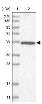 Western Blot NPEPL1 Antibody - BSA Free