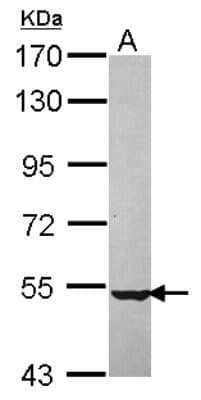 Western Blot NPEPL1 Antibody - BSA Free