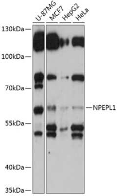 Western Blot: NPEPL1 Antibody [NBP2-93535] - Analysis of extracts of various cell lines, using NPEPL1 at 1:3000 dilution.Secondary antibody: HRP Goat Anti-Rabbit IgG (H+L) at 1:10000 dilution.Lysates/proteins: 25ug per lane.Blocking buffer: 3% nonfat dry milk in TBST.Detection: ECL Basic Kit .Exposure time: 15s.