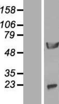 Western Blot: NPEPL1 Overexpression Lysate (Adult Normal) [NBL1-13745] Left-Empty vector transfected control cell lysate (HEK293 cell lysate); Right -Over-expression Lysate for NPEPL1.
