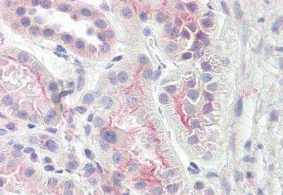 Immunohistochemistry-Paraffin: NPHP4 Antibody [NBP2-47626] - Human kidney