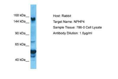 Western Blot: NPHP4 Antibody [NBP2-87938] - Host: Rabbit. Target Name: NPHP4. Sample Type: 786-0 Whole Cell lysates. Antibody Dilution: 1.0ug/ml