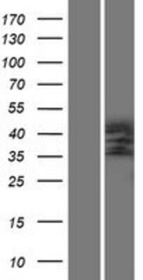 Western Blot Podocin/NPHS2 Overexpression Lysate