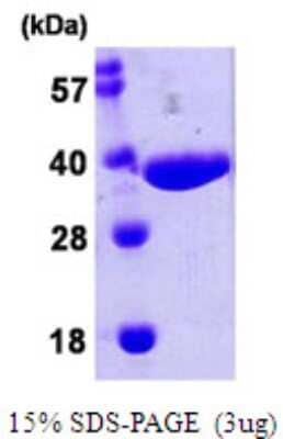 SDS-PAGE Recombinant E. coli NPL His Protein