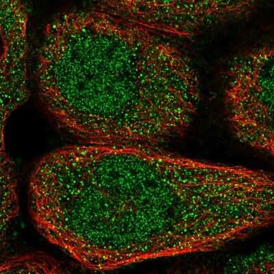 Immunocytochemistry/Immunofluorescence: NPLOC4 Antibody [NBP1-82165] - Staining of human cell line A-431 shows localization to nucleoplasm & cytosol.