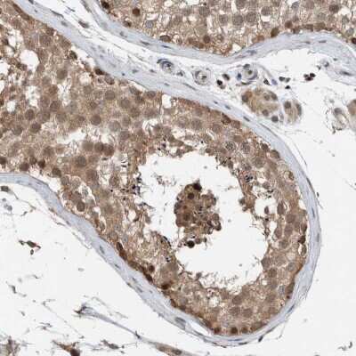 Immunohistochemistry-Paraffin: NPLOC4 Antibody [NBP1-82165] - Staining of human testis shows high expression.