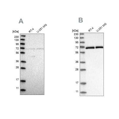 Western Blot NPLOC4 Antibody