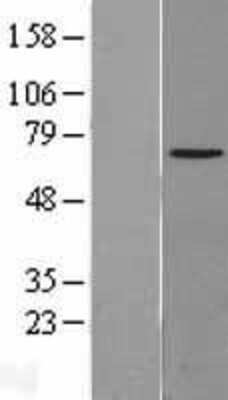 Western Blot: NPLOC4 Overexpression Lysate (Adult Normal) [NBL1-13747] Left-Empty vector transfected control cell lysate (HEK293 cell lysate); Right -Over-expression Lysate for NPLOC4.