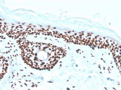 Immunohistochemistry-Paraffin: NPM1 Antibody (rNPM1/1901) - Azide and BSA Free [NBP3-08750] - Formalin-fixed, paraffin-embedded human skin stained with NPM1 Recombinant Mouse Monoclonal Antibody (rNPM1/1901).