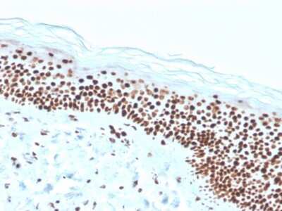 Immunohistochemistry-Paraffin: NPM1 Antibody (rNPM1/1901) - Azide and BSA Free [NBP3-08750] - Formalin-fixed, paraffin-embedded human skin stained with NPM1 Recombinant Mouse Monoclonal Antibody (rNPM1/1901).