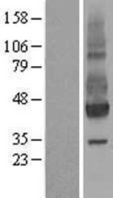 Western Blot: NPTN Overexpression Lysate (Adult Normal) [NBL1-13758] Left-Empty vector transfected control cell lysate (HEK293 cell lysate); Right -Over-expression Lysate for NPTN.