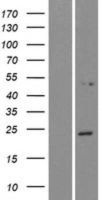 Western Blot: NPVF Overexpression Lysate (Adult Normal) [NBP2-06457] Left-Empty vector transfected control cell lysate (HEK293 cell lysate); Right -Over-expression Lysate for NPVF.