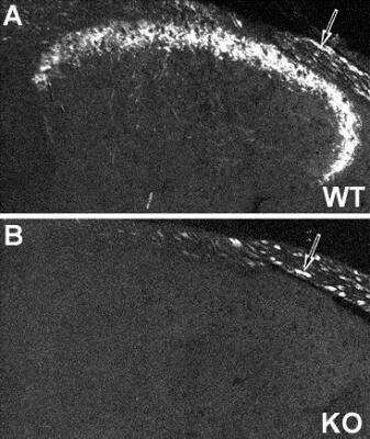 Immunohistochemistry: NPY2R Antibody [NB110-59978] - Image of NPY Y2 receptor immunoreactivity in mouse dorsal root ganglion of wild type (A) and NPY Y2 receptor Knockout (B) animals.  Note that  unspecific staining is observed in thick, possibly myelinated fibers.