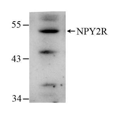 Western Blot: NPY2R Antibody [NB110-59978] - analysis of NPY2R in rat hypothalamus lysate using anti-NPY2R antibody. Image from verified customer review.