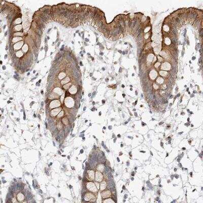 Immunohistochemistry-Paraffin NPY4R Antibody