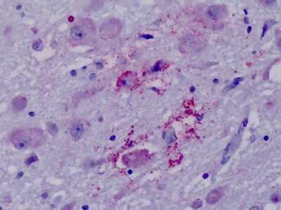 Immunohistochemistry-Paraffin: NPY4R Antibody [NLS1070] - Analysis of anti-PPYR1 antibody with human brain, hypothalamus at dilution 16 ug/ml.