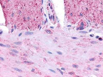 Immunohistochemistry-Paraffin: NPY4R Antibody [NLS1071] - Analysis of anti-NPY4R / PPYR1 antibody with small intestine, muscularis propria.