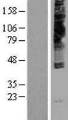 Western Blot: NPY4R Overexpression Lysate (Adult Normal) [NBP2-10436] Left-Empty vector transfected control cell lysate (HEK293 cell lysate); Right -Over-expression Lysate for NPY4R.