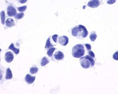 Immunocytochemistry/Immunofluorescence: NPY5R Antibody [NLS1077] - Analysis of anti-NPY5R antibody with transfection control.