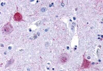 Immunohistochemistry-Paraffin: NPY5R Antibody [NBP3-14427] - Immunohistochemistry of formalin-fixed, paraffin-embedded human brain, cortex, after heat-induced antigen retrieval.
