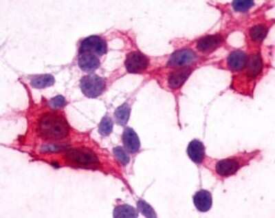 Immunohistochemistry-Paraffin: NPY5R Antibody [NLS1074] - Analysis of anti-NPY5R antibody with transfection positive.