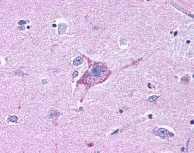 Immunohistochemistry-Paraffin: NPY5R Antibody [NLS1074] - Analysis of anti-NPY5R antibody with human brain, neurons and glia at 7 ug/ml.