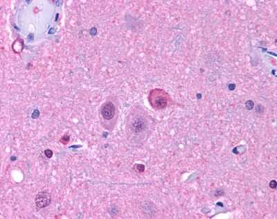 Immunohistochemistry-Paraffin: NPY5R Antibody [NLS1077] - Analysis of anti-NPY5R antibody with human brain, neurons and glia at 4 ug/ml.
