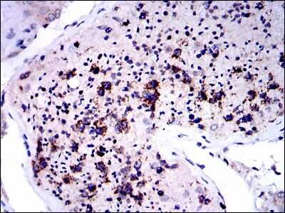 Immunohistochemistry: NQO-1 Antibody (4D12) [NBP2-37541] - Immunohistochemical analysis of paraffin-embedded testis tissues using NQO1 mouse mAb with DAB staining.