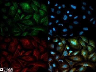 Immunocytochemistry/Immunofluorescence: NQO-1 Antibody (A180) - Azide and BSA Free [NBP2-80885] - NQO1 antibody was tested in U2OS cells with Dylight 488 (green). Nuclei and beta-tubulin were counterstained with DAPI (blue) and Dylight 550 (red). Image from the standard format of this antibody.