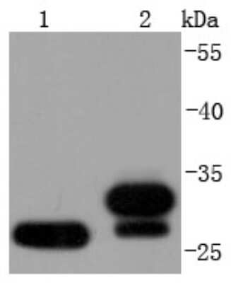 Western Blot: NQO-1 Antibody (JF440-1) [NBP2-66990] - Analysis of NQO1 on different lysates using anti-NQO1 antibody at 1/1,000 dilution. Positive control: Lane 1: SH-SY-5Y Lane 2: Mouse kidney Lane 3: Raji