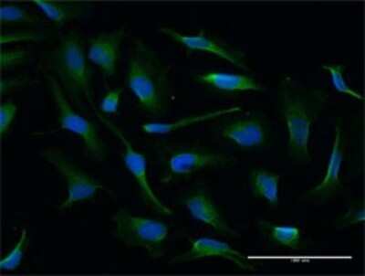 Immunocytochemistry/Immunofluorescence: NQO-2 Antibody [H00004835-D01P] - Analysis of antibody to NQO2 on HeLa cell. Antibody concentration 10 ug/ml.