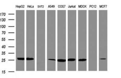 Western Blot: NQO-2 Antibody (OTI3C11) - Azide and BSA Free [NBP2-73045] - Analysis of extracts (35ug) from 9 different cell line (HepG2: human; HeLa: human; SVT2: mouse; A549: human; COS7: monkey; Jurkat: human; MDCK: canine; PC12: rat; MCF7: human).