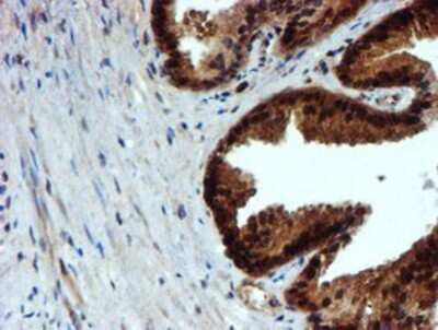 Immunohistochemistry: NQO-2 Antibody (OTI3G4) - Azide and BSA Free [NBP2-73049] - Staining of paraffin-embedded Human prostate tissue using anti-NQO2 mouse monoclonal antibody.