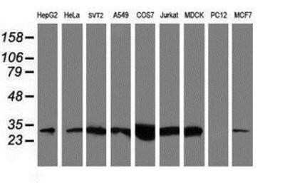 Western Blot: NQO-2 Antibody (OTI3G4) - Azide and BSA Free [NBP2-73049] - Analysis of extracts (35ug) from 9 different cell lines by using g anti-NQO2 monoclonal antibody (HepG2: human; HeLa: human; SVT2: mouse; A549: human; COS7: monkey; Jurkat: human; MDCK: canine; PC12: rat; MCF7: human).