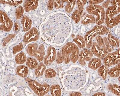 Immunohistochemistry-Paraffin: NQO-2 Antibody (SC06-68) [NBP2-67638] - Analysis of paraffin-embedded human kidney tissue using anti-NQO2 antibody. The section was pre-treated using heat mediated antigen retrieval with Tris-EDTA buffer (pH 8.0-8.4) for 20 minutes.The tissues were blocked in 5% BSA for 30 minutes at room temperature, washed with ddH2O and PBS, and then probed with the primary antibody (1/200) for 30 minutes at room temperature. The detection was performed using an HRP conjugated compact polymer system. DAB was used as the chromogen. Tissues were counterstained with hematoxylin and mounted with DPX.