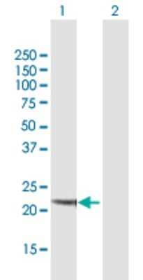 Western Blot: NQO-2 Antibody [H00004835-B01P] - Analysis of NQO2 expression in transfected 293T cell line by NQO2 polyclonal antibody.  Lane 1: NQO2 transfected lysate(25.41 KDa). Lane 2: Non-transfected lysate.