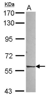 Western Blot: Rev-erb beta/NR1D2 Antibody [NBP2-19576] -  Sample (30 ug of whole cell lysate) A: NT2D1 7. 5% SDS PAGE gel, diluted at 1:1000.