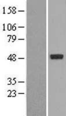 Western Blot: NR1I2 Overexpression Lysate (Adult Normal) [NBL1-13770] Left-Empty vector transfected control cell lysate (HEK293 cell lysate); Right -Over-expression Lysate for NR1I2.