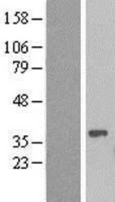 Western Blot: NR1I3 Overexpression Lysate (Adult Normal) [NBP2-08456] Left-Empty vector transfected control cell lysate (HEK293 cell lysate); Right -Over-expression Lysate for NR1I3.