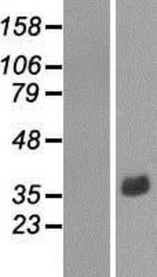 Western Blot: NR1I3 Overexpression Lysate (Adult Normal) [NBP2-09261] Left-Empty vector transfected control cell lysate (HEK293 cell lysate); Right -Over-expression Lysate for NR1I3.