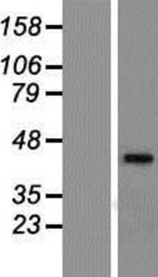 Western Blot: NR1I3 Overexpression Lysate (Adult Normal) [NBP2-09262] Left-Empty vector transfected control cell lysate (HEK293 cell lysate); Right -Over-expression Lysate for NR1I3.