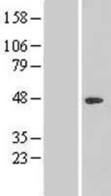 Western Blot: NR2C1 Overexpression Lysate (Adult Normal) [NBL1-13771] Left-Empty vector transfected control cell lysate (HEK293 cell lysate); Right -Over-expression Lysate for NR2C1.