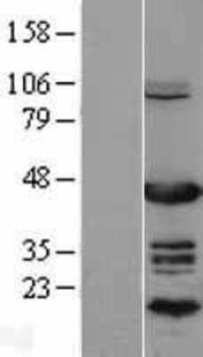 Western Blot EAR2/NR2F6 Overexpression Lysate