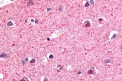 Immunohistochemistry-Paraffin: NR4A3/NOR1 Antibody [NBP1-44128] - Anti-NR4A3 antibody IHC of human brain, neurons and glia. Immunohistochemistry of formalin-fixed, paraffin-embedded tissue after heat-induced antigen retrieval.