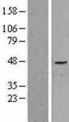 Western Blot: NR5A2/LRH1 Overexpression Lysate (Adult Normal) [NBP2-04258] Left-Empty vector transfected control cell lysate (HEK293 cell lysate); Right -Over-expression Lysate for NR5A2/LRH1.