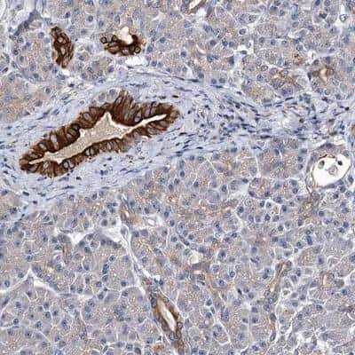 Immunohistochemistry-Paraffin: NRAMP2/SLC11A2/DMT1 Antibody [NBP1-91840] - Staining of human pancreas shows strong cytoplasmic and membranous positivity in pancreatic ducts.