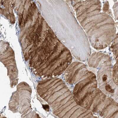 Immunohistochemistry: NRAP Antibody [NBP2-32650] - Staining of human skeletal muscle shows strong cytoplasmic positivity in myocytes.