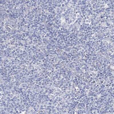 <b>Independent Antibodies Validation. </b>Immunohistochemistry-Paraffin: NRAP Antibody [NBP1-86267] - Staining of human tonsil shows no positivity in non-germinal center cells as expected.