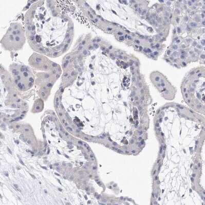 Immunohistochemistry-Paraffin: NRAP Antibody [NBP1-86267] - Staining of human placenta shows no positivity in trophoblastic cells as expected.